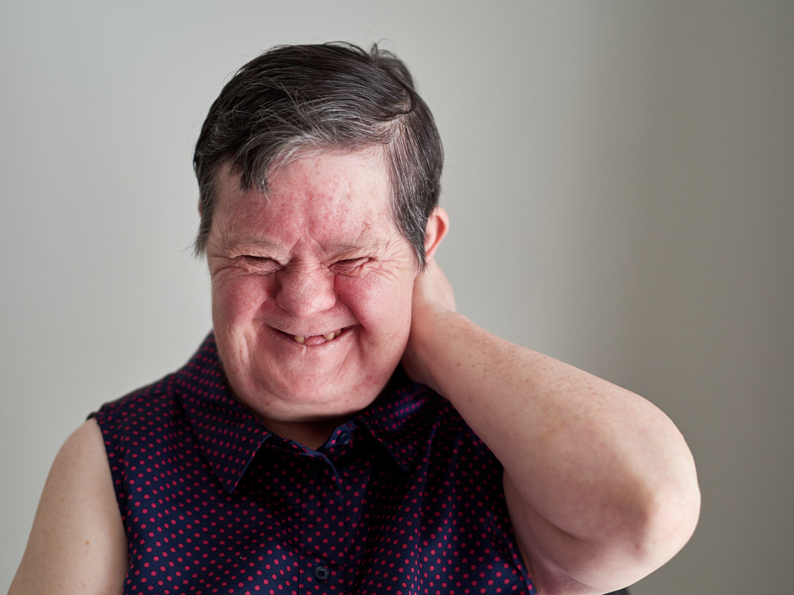 Photo of a woman with disability, laughing with her hand up behind her head.